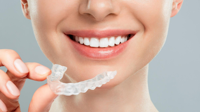 aparat ortodontyczny Invisalign