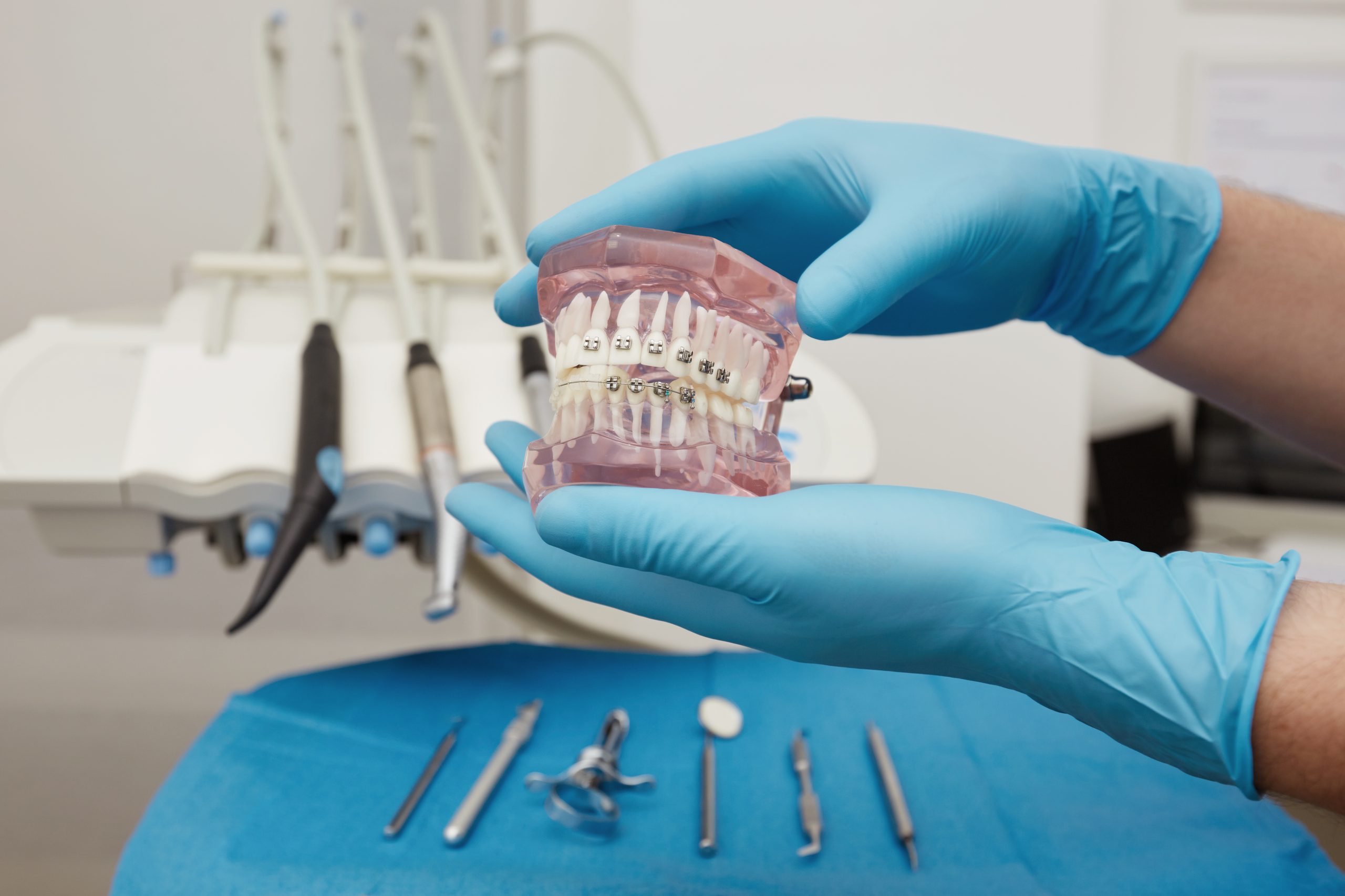 Aparat ortodontyczny Katowice - Dłucik Dental Clinic