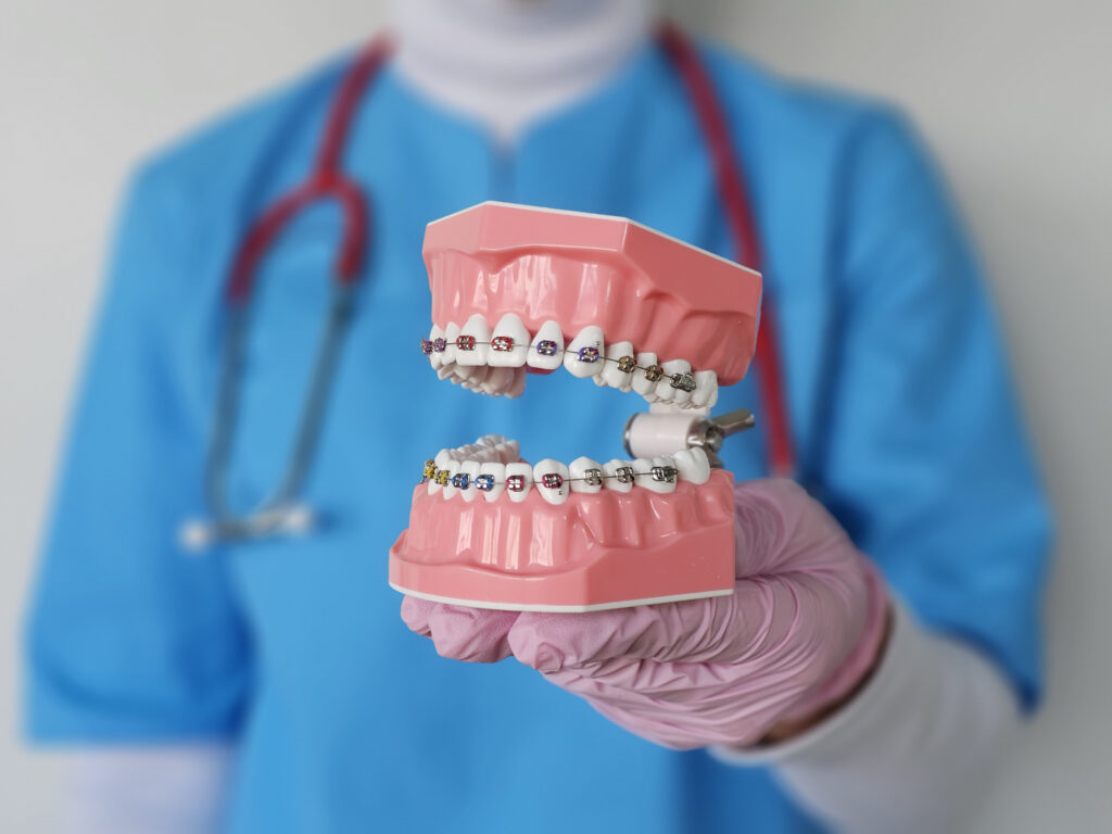 Rodzaje leczenia ortodontycznego - Dłucik Dental Clinic Katowice